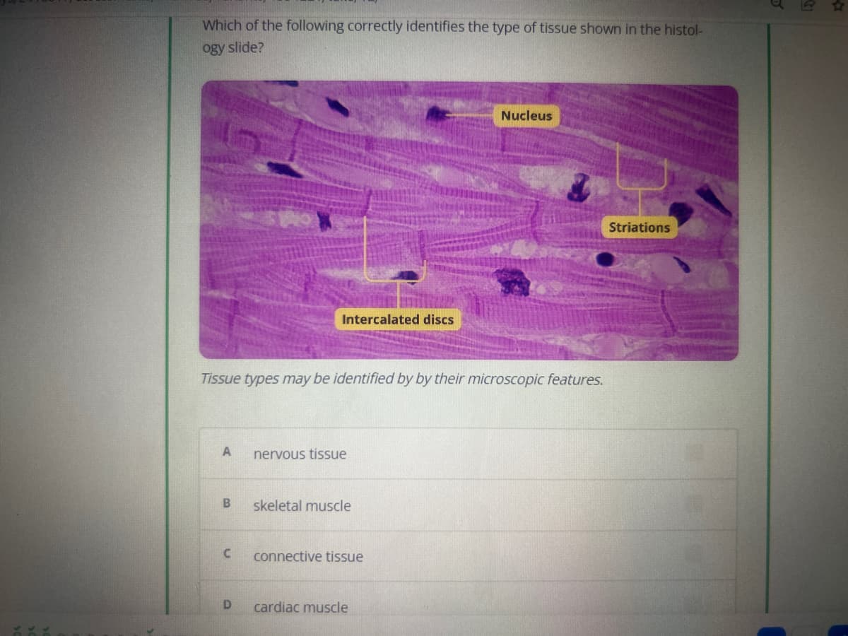 Which of the following correctly identifies the type of tissue shown in the histol-
ogy slide?
A
Tissue types may be identified by by their microscopic features.
B
C
Intercalated discs
D
nervous tissue
skeletal muscle
connective tissue
Nucleus
cardiac muscle
Striations