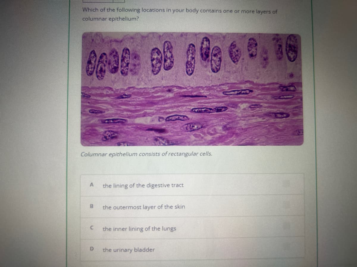 Which of the following locations in your body contains one or more layers of
columnar epithelium?
0038: 98 80 6.0
Columnar epithelium consists of rectangular cells.
A
B
C
D
FUCK
the lining of the digestive tract
the outermost layer of the skin
the inner lining of the lungs
the urinary bladder