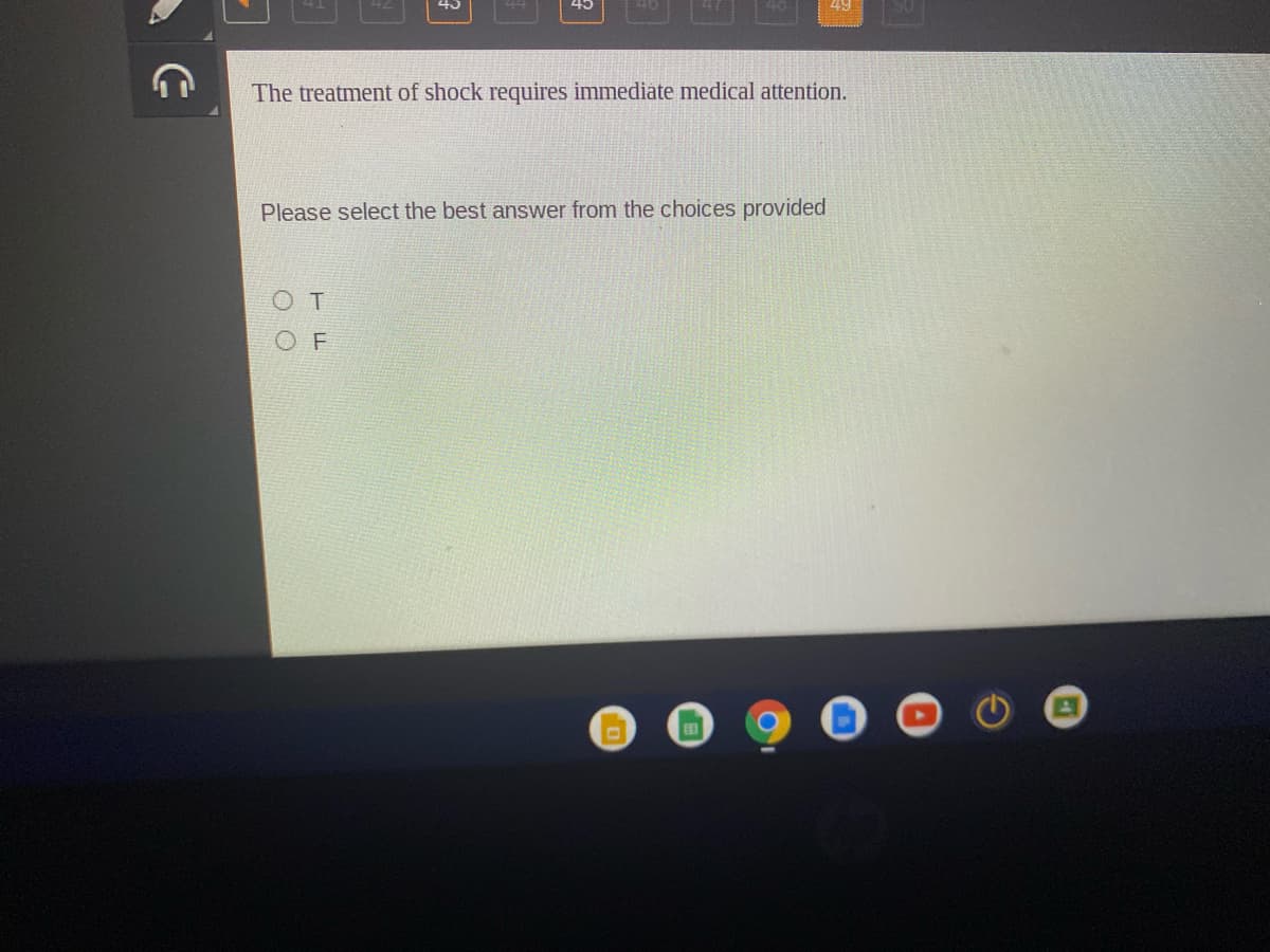 45
45
49
The treatment of shock requires immediate medical attention.
Please select the best answer from the choices provided
OT
O F
