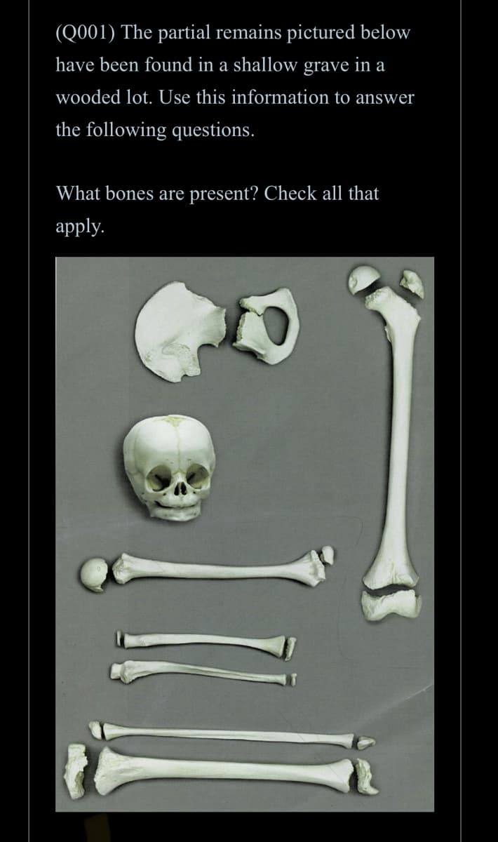 (Q001) The partial remains pictured below
have been found in a shallow grave in a
wooded lot. Use this information to answer
the following questions.
What bones are present? Check all that
apply.