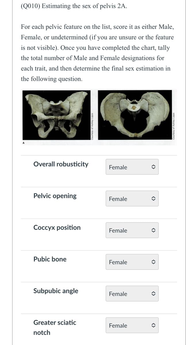 (Q010) Estimating the sex of pelvis 2A.
For each pelvic feature on the list, score it as either Male,
Female, or undetermined (if you are unsure or the feature
is not visible). Once you have completed the chart, tally
the total number of Male and Female designations for
each trait, and then determine the final sex estimation in
the following question.
Overall robusticity
Female
Pelvic opening
Female
Coccyx position
Female
Pubic bone
Female
Subpubic angle
Female
<>
<>
Greater sciatic
Female
=
notch