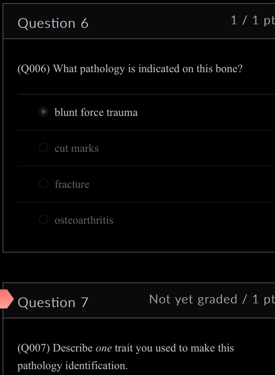Question 6
1/1 pt
(Q006) What pathology is indicated on this bone?
blunt force trauma
cut marks
fracture
osteoarthritis
Question 7
Not yet graded / 1 pt
(Q007) Describe one trait you used to make this
pathology identification.