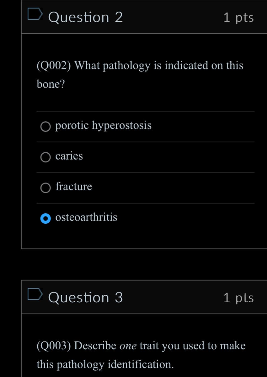 □ Question 2
1 pts
(Q002) What pathology is indicated on this
bone?
O porotic hyperostosis
caries
fracture
osteoarthritis
Question 3
1 pts
(Q003) Describe one trait you used to make
this pathology identification.