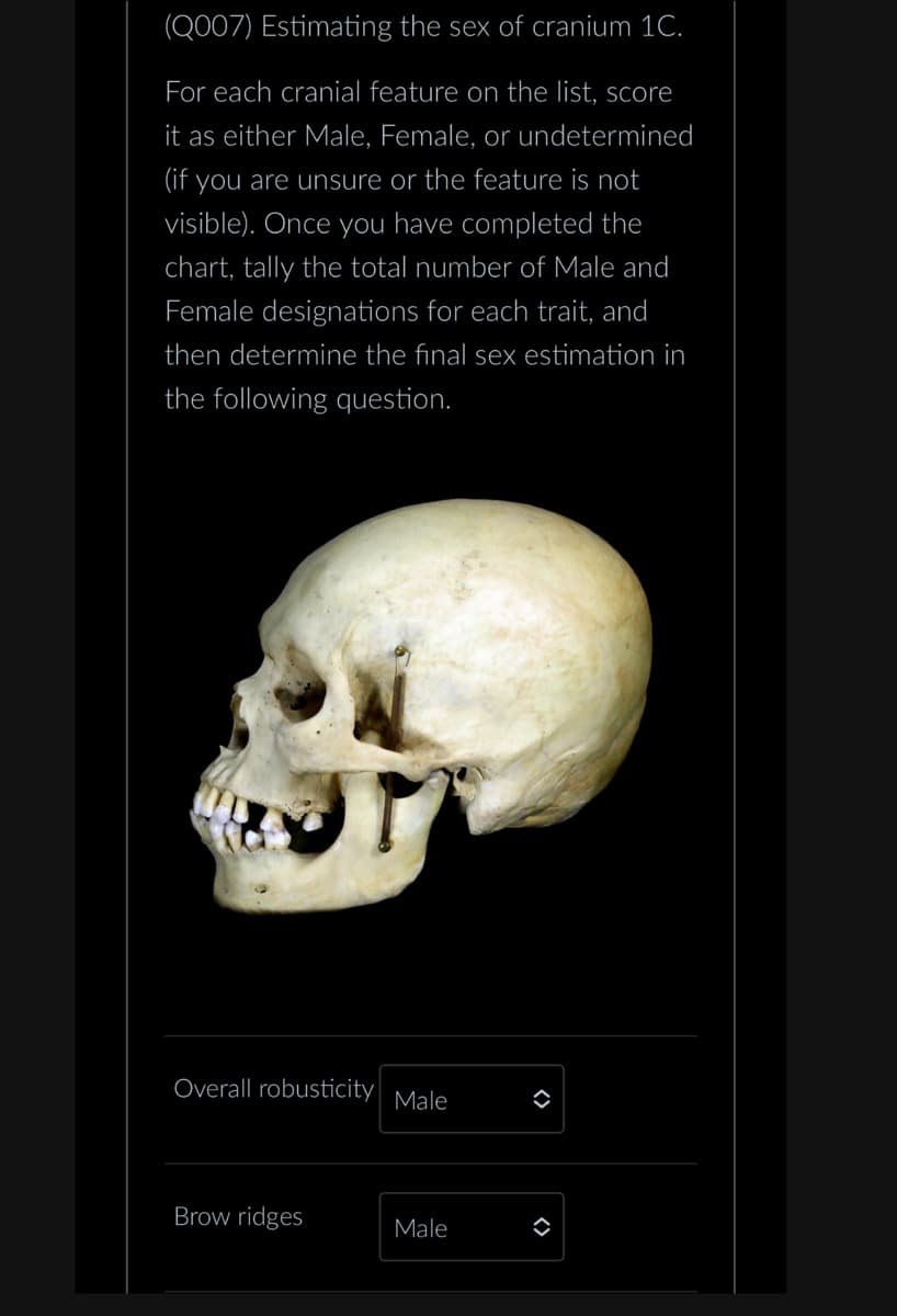 (Q007) Estimating the sex of cranium 1C.
For each cranial feature on the list, score
it as either Male, Female, or undetermined
(if you are unsure or the feature is not
visible). Once you have completed the
chart, tally the total number of Male and
Female designations for each trait, and
then determine the final sex estimation in
the following question.
Overall robusticity
Male
=
Brow ridges
Male