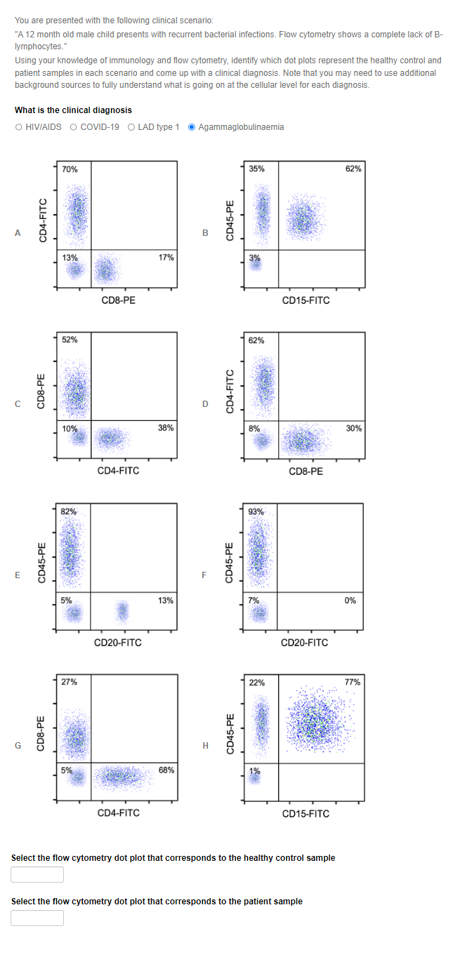 You are presented with the following clinical scenario:
"A 12 month old male child presents with recurrent bacterial infections. Flow cytometry shows a complete lack of B-
lymphocytes."
Using your knowledge of immunology and flow cytometry, identify which dot plots represent the healthy control and
patient samples in each scenario and come up with a clinical diagnosis. Note that you may need to use additional
background sources to fully understand what is going on at the cellular level for each diagnosis.
What is the clinical diagnosis
O HIV/AIDS O COVID-19 O LAD type 1
U
E
CD4-FITC
CD8-PE
CD45-PE
CD8-PE
70%
13%
52%
10%
82%
5%
27%
5%
CD8-PE
CD4-FITC
CD20-FITC
CD4-FITC
17%
38%
13%
68%
Agammaglobulinaemia
CD45-PE
CD4-FITC
CD45-PE
CD45-PE
35%
3%
62%
8%
93%
22%
CD15-FITC
CD8-PE
CD20-FITC
CD15-FITC
Select the flow cytometry dot plot that corresponds to the healthy control sample
Select the flow cytometry dot plot that corresponds to the patient sample
62%
30%
0%
77%