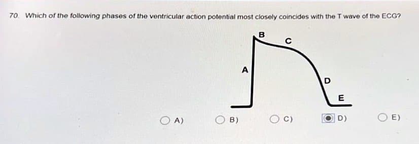 70 Which of the following phases of the ventricular action potential most closely coincides with the T wave of the ECG?
OA)
OB)
A
B
с
O C)
D
E
D)
E)