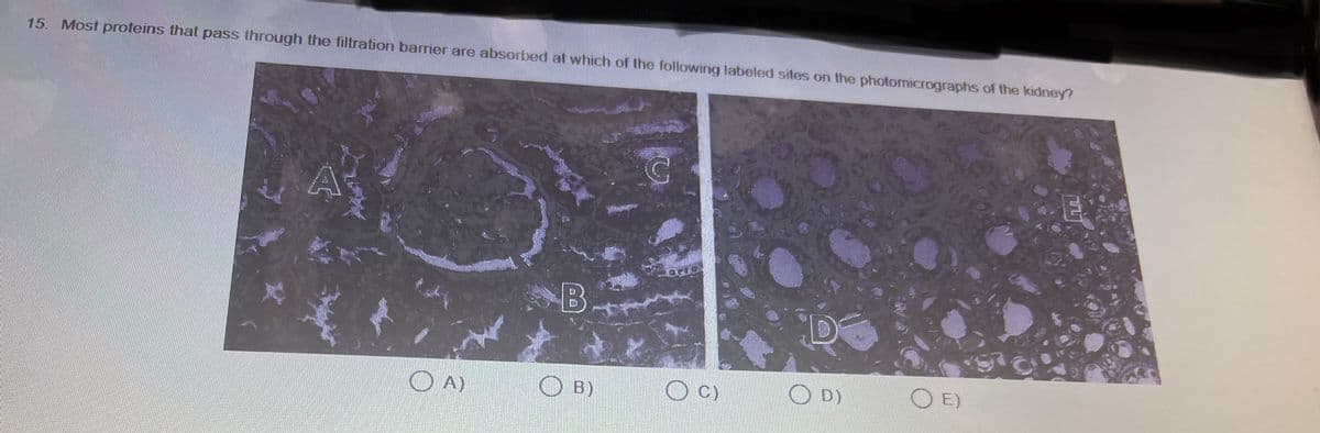 15. Most proteins that pass through the filtration barrier are absorbed at which of the following labeled sites on the photomicrographs of the kidney?
A
OA)
B
OB)
G
ORIO
(C)
D
OD)
OE)
TU