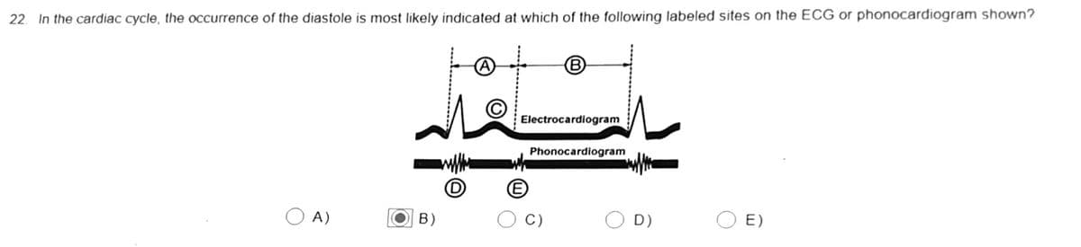 22. In the cardiac cycle, the occurrence of the diastole is most likely indicated at which of the following labeled sites on the ECG or phonocardiogram shown?
O A)
B)
D
(A)
Electrocardiogram
(E
B
Phonocardiogram
C)
D)
E)
