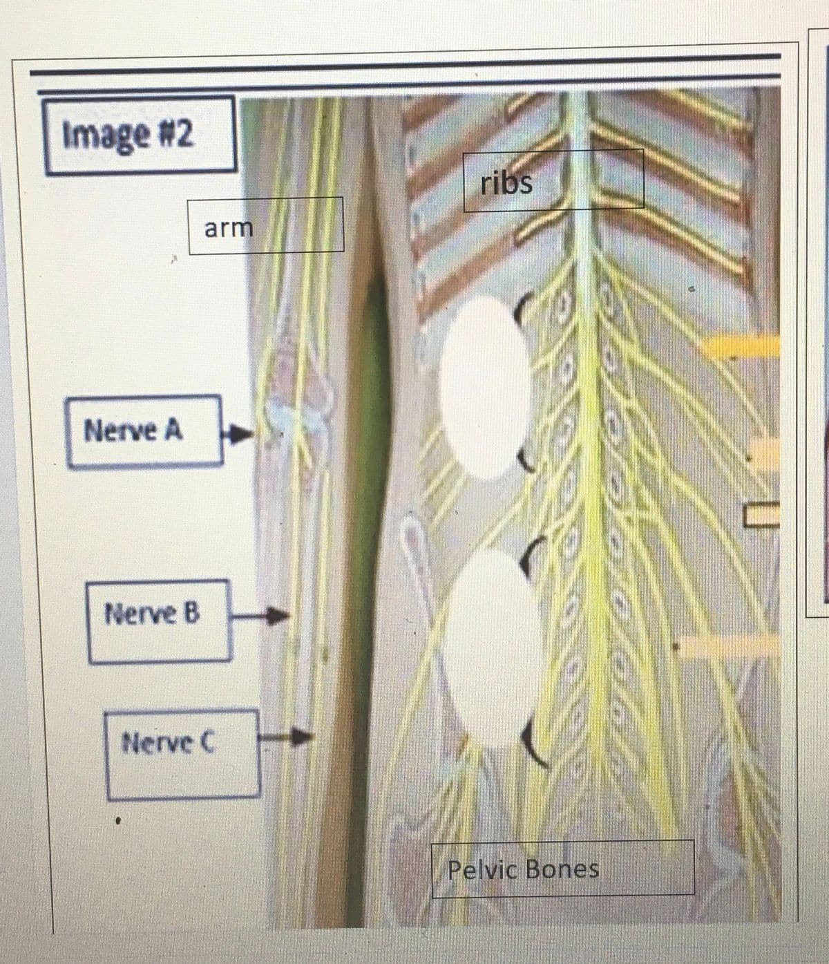 Image #2
Nerve A
Nerve B
arm
Nerve C
ribs
Pelvic Bones
U
