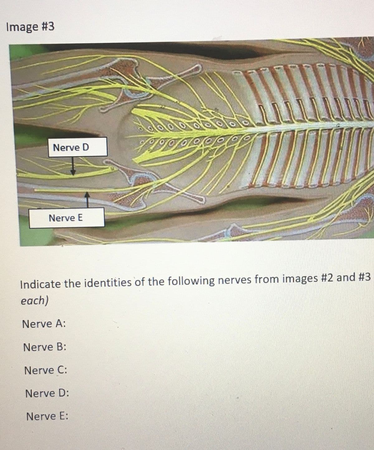 Image #3
Nerve D
Nerve E
2900
Nerve B:
Nerve C:
Nerve D:
Nerve E:
OOK
Indicate the identities of the following nerves from images #2 and #3
each)
Nerve A: