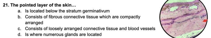 21. The pointed layer of the skin...
a. Is located below the stratum germinativum
b. Consists of fibrous connective tissue which are compactly
arranged
c. Consists of loosely arranged connective tissue and blood vessels
d. Is where numerous glands are located
