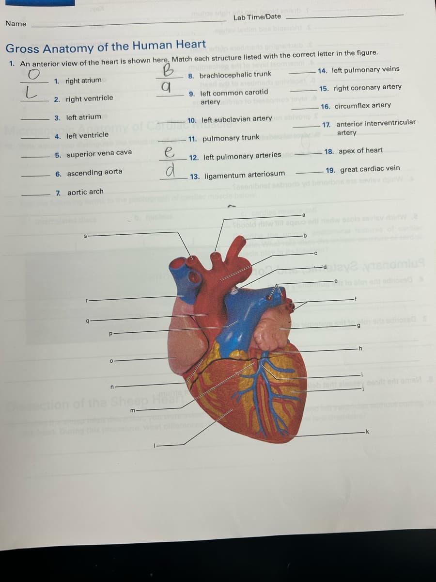 Name
Gross Anatomy of the Human Heart
1. An anterior view of the heart is shown here. Match each structure listed with the correct letter in the figure.
B
8. brachiocephalic trunk
14. left pulmonary veins
q
9. left common carotid
15. right coronary artery
16. circumflex artery
L
1. right atrium
2. right ventricle
3. left atrium
4. left ventricle
5. superior vena cava
6. ascending aorta
7. aortic arch
P
e
d
Lab Time/Date
of the Sheep Hean
m
artery sibies to beaogmos 10Ysl 8
10. left subclavian artery un abivorq X
11. pulmonary trunk beloopiaci
12. left pulmonary arteries
13. ligamentum arteriosum
17. anterior interventricular
artery
18. apex of heart
19. great cardiac vein
Sesenibnet esboro yd besorone ens seviev doinW
c. cardiac muscle
Sboold ritiw 1lit aqavo orli nedw esolo sevisvrbinWe
the unla banitom
C
stay2 visnomius
Vibroming to slow aris adinozed
adi tolos si edhpeed X
ilob tsrt aleasey eendi edi ama 8