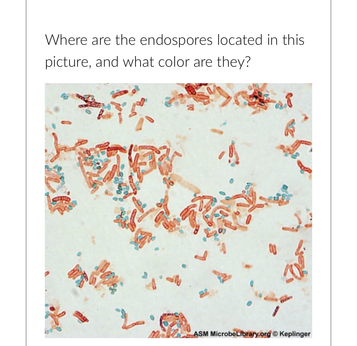 Where are the endospores located in this
picture, and what color are they?
20
00
ASM MicrobeLibrary.org Ⓒ Keplinger