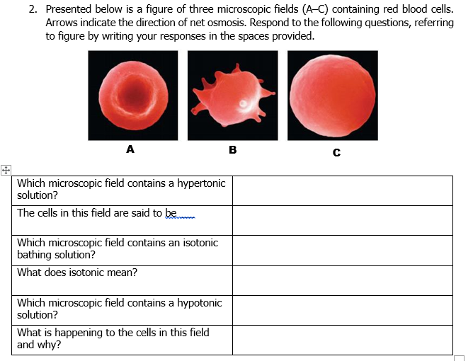 2. Presented below is a figure of three microscopic fields (A-C) containing red blood cells.
Arrows indicate the direction of net osmosis. Respond to the following questions, referring
to figure by writing your responses in the spaces provided.
A
B
Which microscopic field contains a hypertonic
solution?
The cells in this field are said to be
Which microscopic field contains an isotonic
bathing solution?
What does isotonic mean?
Which microscopic field contains a hypotonic
solution?
What is happening to the cells in this field
and why?
