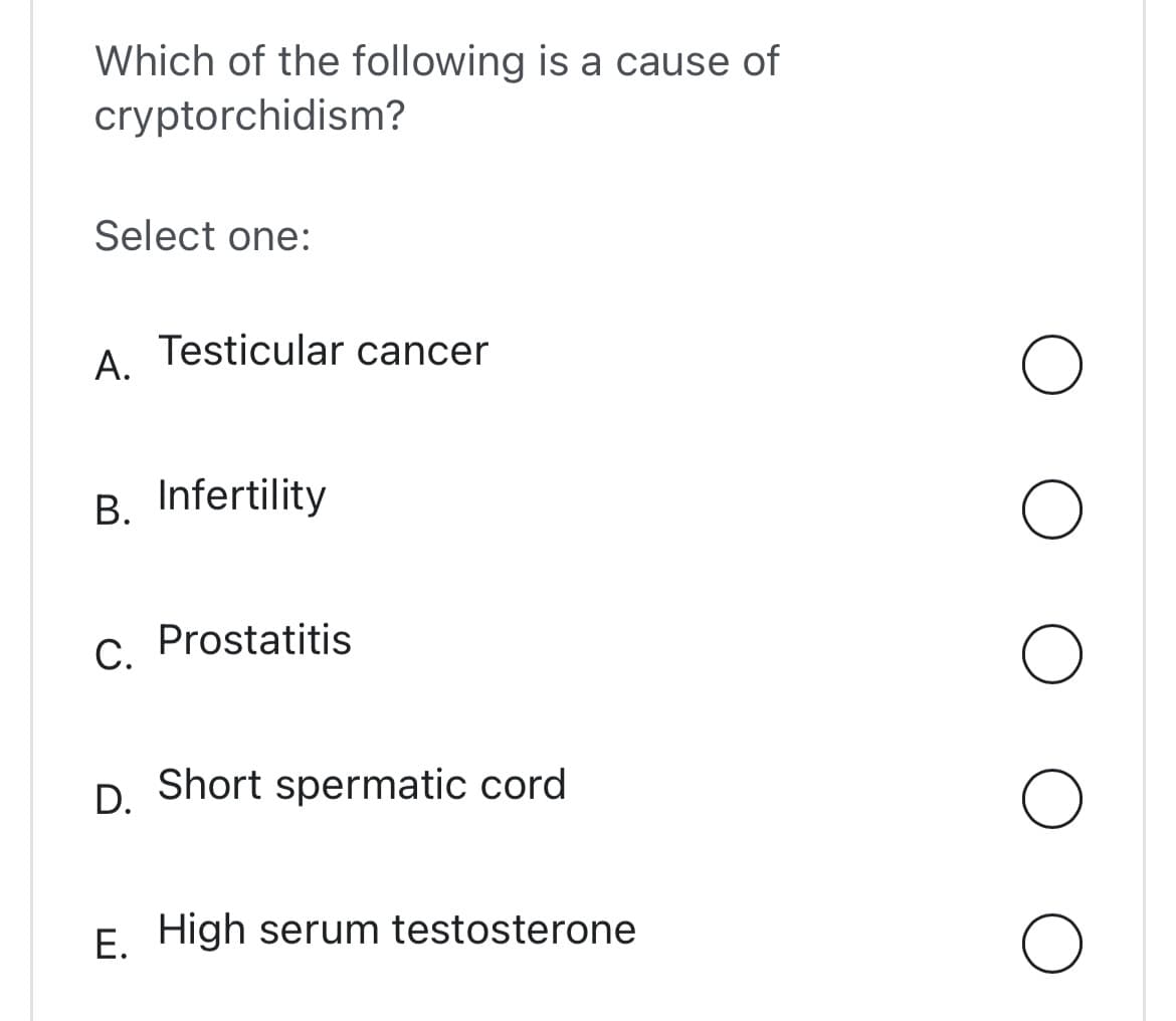 Which of the following is a cause of
cryptorchidism?
Select one:
A.
Testicular cancer
B. Infertility
C. Prostatitis
D. Short spermatic cord
E. High serum testosterone
O
O
O
O
O
