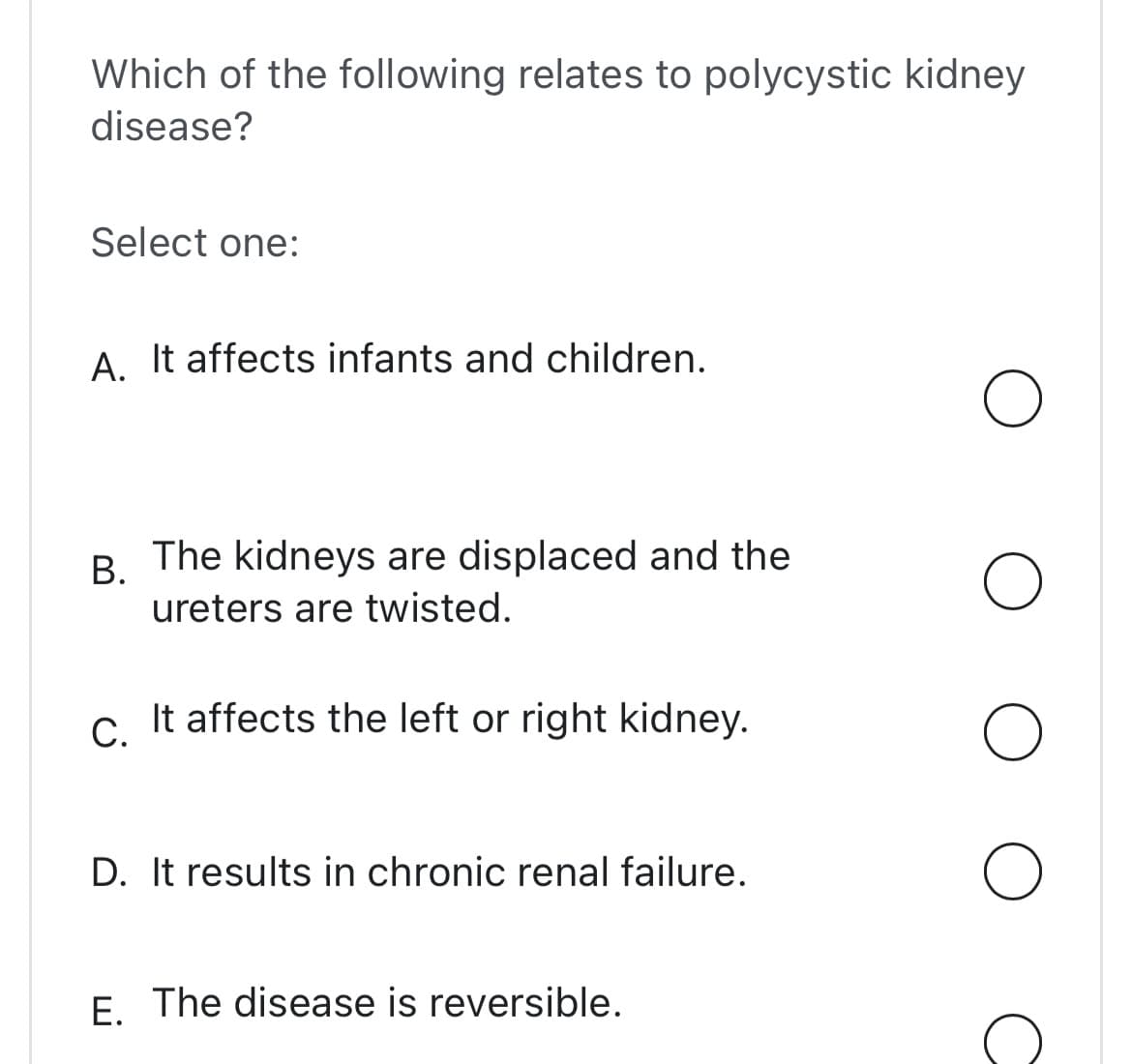 Which of the following relates to polycystic kidney
disease?
Select one:
A. It affects infants and children.
B.
The kidneys are displaced and the
ureters are twisted.
C.
It affects the left or right kidney.
D. It results in chronic renal failure.
E. The disease is reversible.
O
O
O
с