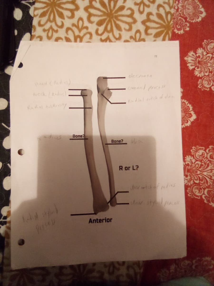 Head (Radius)
Neck (Radius).
Radial tuberosity,
وب اليه
Radial styloid
Bone?
E
Bone?
ole canon
Anterior
coronoid process
Radial notch of ulna
ula
72
R or L?
Artch of radius
•Unar styloid process