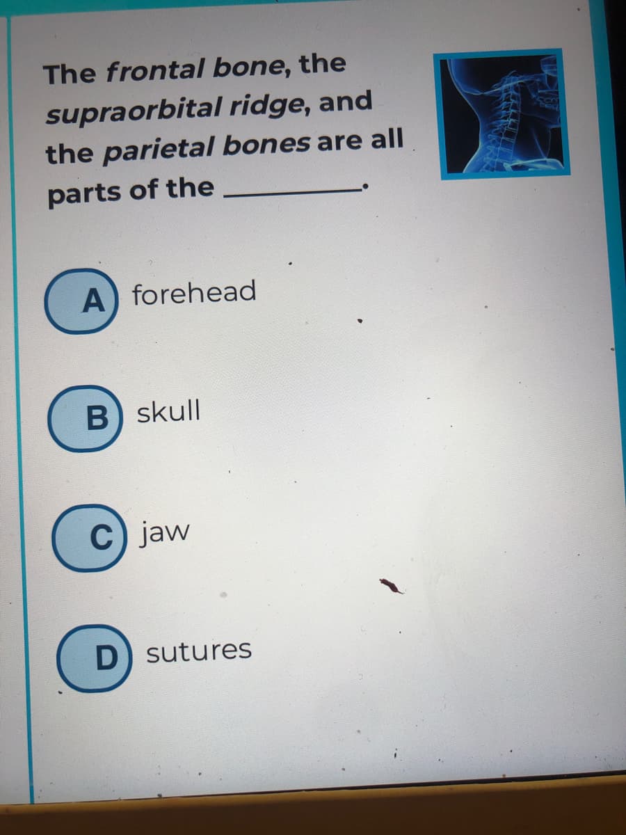 The frontal bone, the
supraorbital ridge, and
the parietal bones are all
parts of the
A) forehead
B) skull
C) jaw
D) sutures
