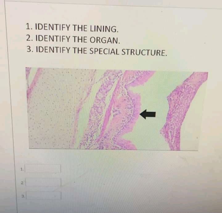 1. IDENTIFY THE LINING.
2. IDENTIFY THE ORGAN.
3. IDENTIFY THE SPECIAL STRUCTURE.
1.
2.
3.
