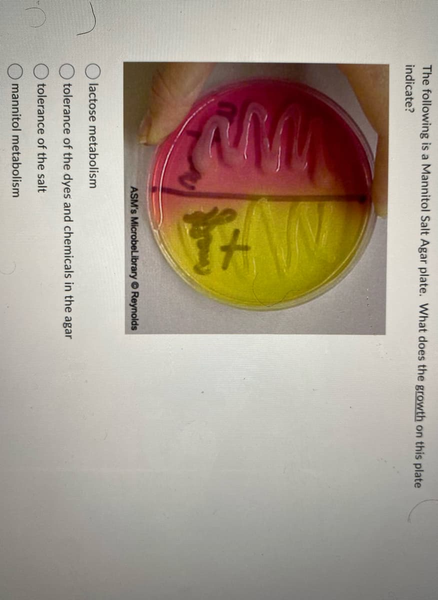 O
The following is a Mannitol Salt Agar plate. What does the growth on this plate
indicate?
www
TAN
ASM's MicrobeLibrary Reynolds
lactose metabolism
tolerance of the dyes and chemicals in the agar
tolerance of the salt
mannitol metabolism