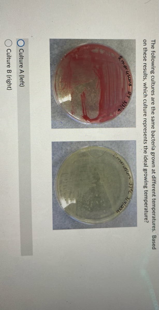 The following cultures are the same bacteria grown at different temperatures. Based
on these results, which culture represents the ideal growing temperature?
S.marcescens
Culture A (left)
Culture B (right)
RT
3/3/16
37%
marusurs
3/4/2016
com.co