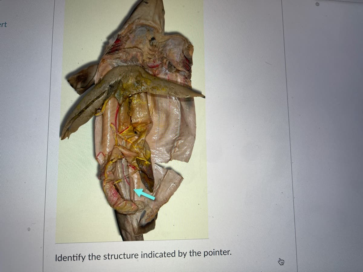 ert
Identify the structure indicated by the pointer.
