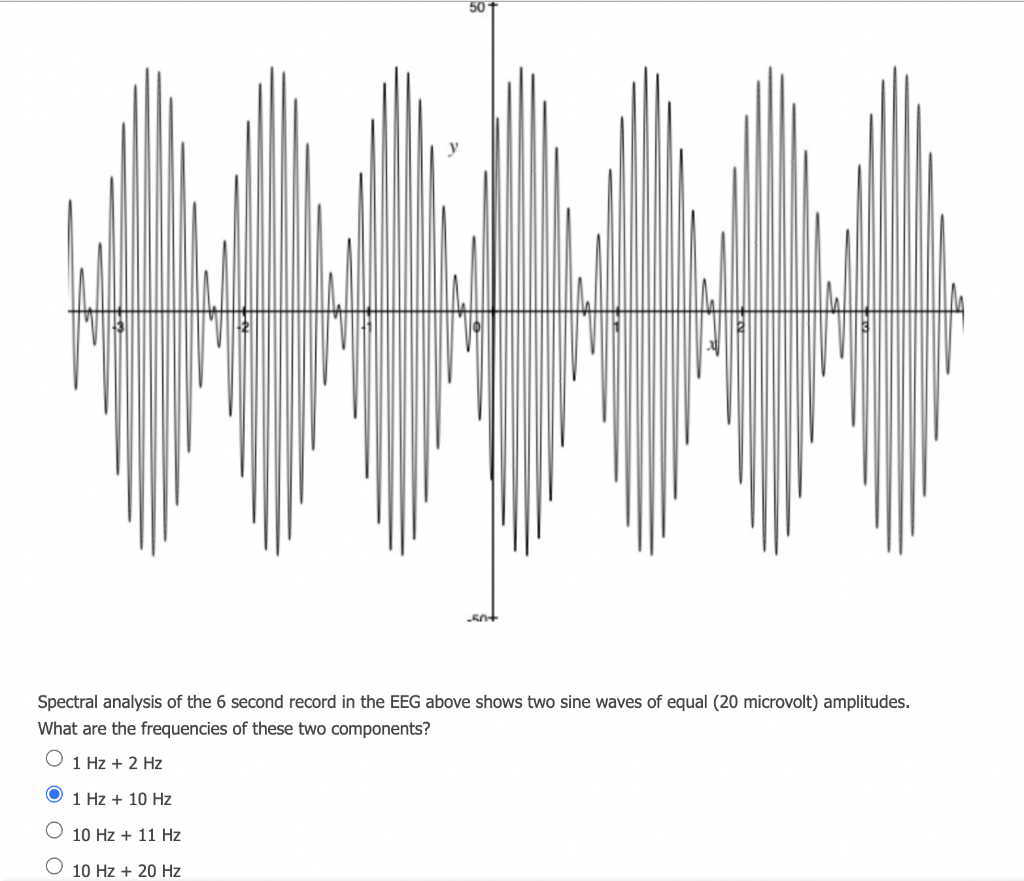 50
knt
Spectral analysis of the 6 second record in the EEG above shows two sine waves of equal (20 microvolt) amplitudes.
What are the frequencies of these two components?
O 1 Hz + 2 Hz
1 Hz + 10 Hz
10 Hz + 11 Hz
10 Hz + 20 Hz
