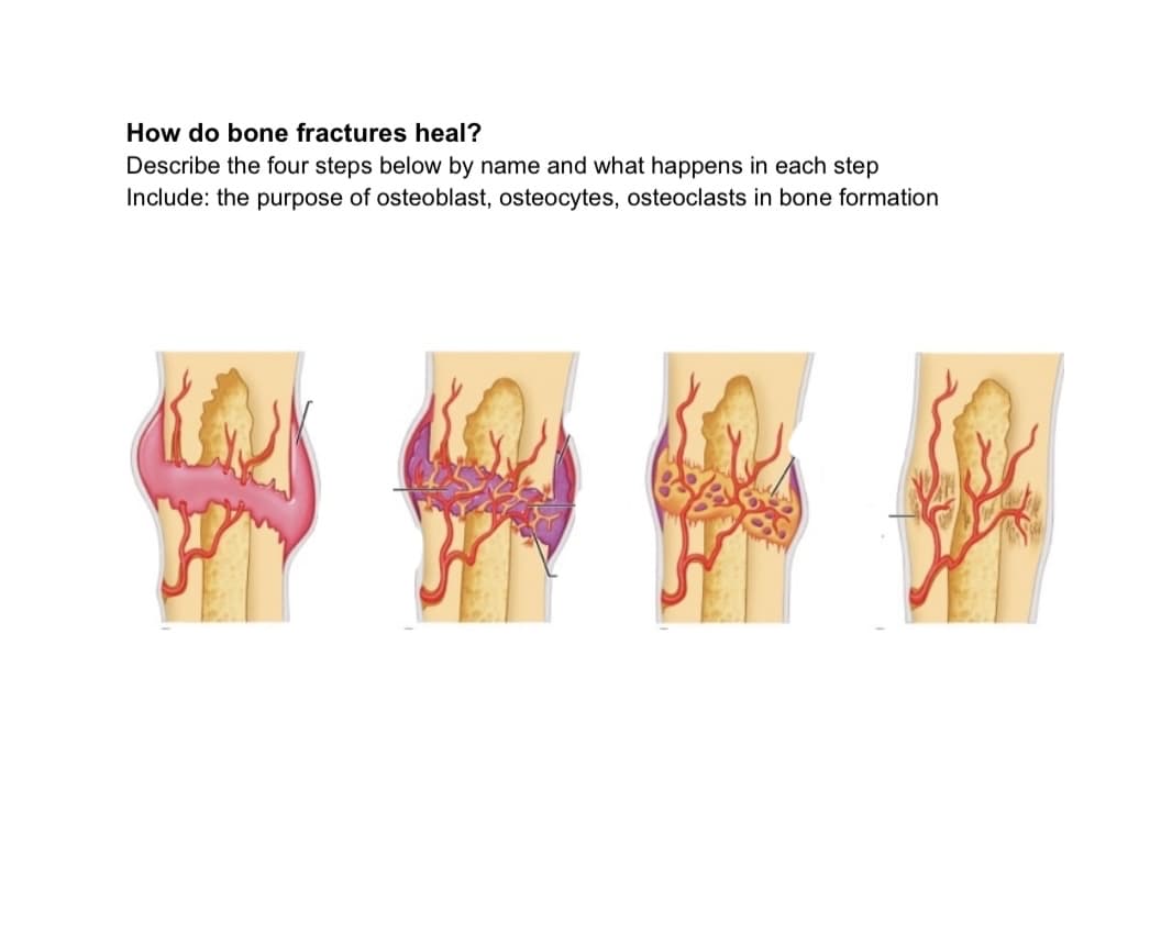 How do bone fractures heal?
Describe the four steps below by name and what happens in each step
Include: the purpose of osteoblast, osteocytes, osteoclasts in bone formation