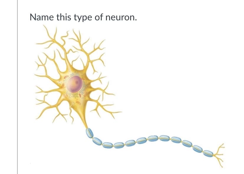 Name this type of neuron.
