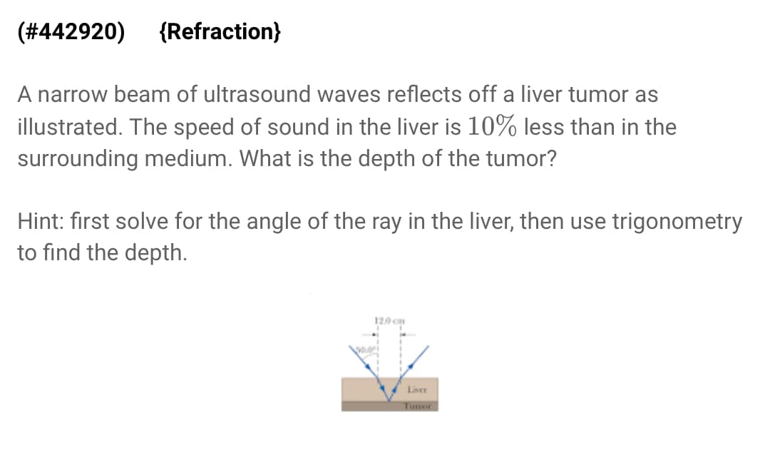 (#442920) {Refraction}
A narrow beam of ultrasound waves reflects off a liver tumor as
illustrated. The speed of sound in the liver is 10% less than in the
surrounding medium. What is the depth of the tumor?
Hint: first solve for the angle of the ray in the liver, then use trigonometry
to find the depth.
120 cm
Liver
Tumor