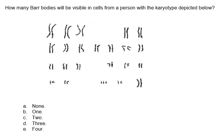 How many Barr bodies will be visible in cells from a person with the karyotype depicted below?
a. None.
b. One.
Two.
$$
ку
K ) K Kral 55 }}
)) se
(5 11
}}
C.
d. Three.
e. Four.
21
}<
SF 31
(r