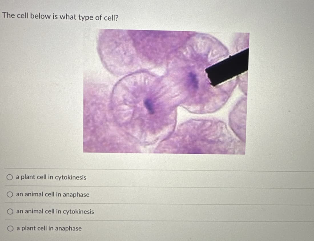 The cell below is what type of cell?
O a plant cell in cytokinesis
an animal cell in anaphase
an animal cell in cytokinesis
O a plant cell in anaphase