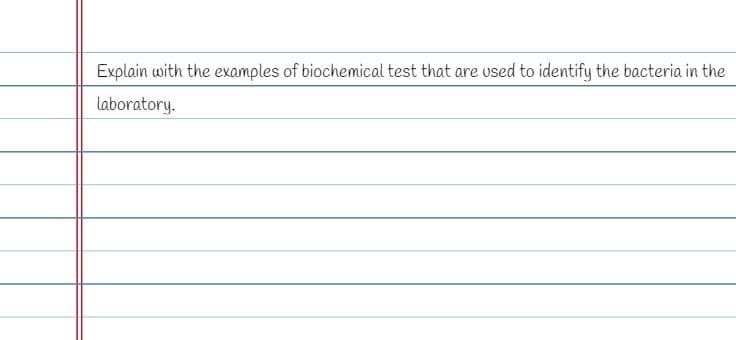 Explain with the examples of biochemical test that are used to identify the bacteria in the
laboratory.