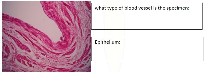 what type of blood vessel is the specimen:
Epithelium:
