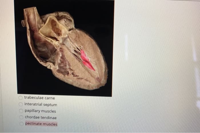 0
0 0 0 0 0
trabeculae carne
interatrial
septum
papillary
muscles
chordae tendinae
pectinate muscles