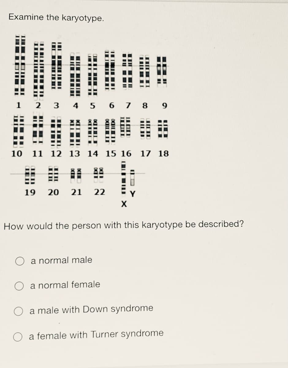 Examine the karyotype.
3.
4
7
8
10
11 12 13 14 15 16
17 18
20
21
22
How would the person with this karyotype be described?
O a normal male
O a normal female
O a male with Down syndrome
O a female with Turner syndrome
1車D 9
