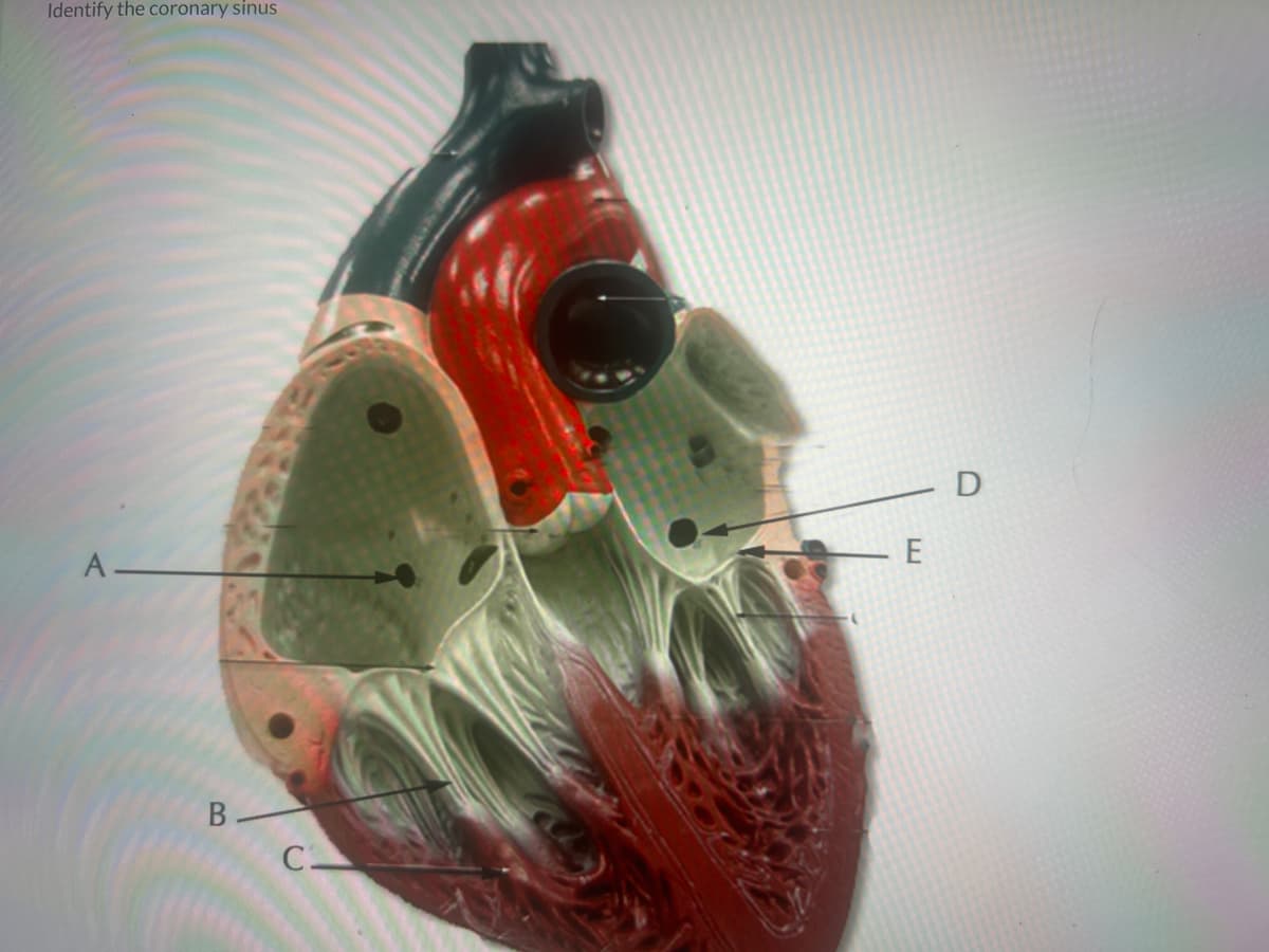 Identify the coronary sinus
A
B-
C
- D
- Ε