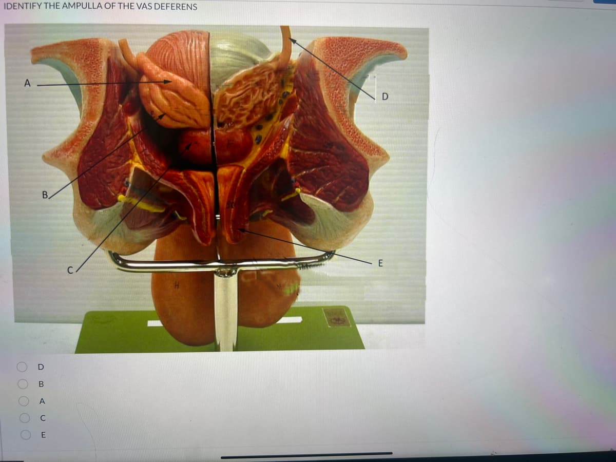 IDENTIFY THE AMPULLA OF THE VAS DEFERENS
A
0 0 0 0 0
В.
D
A
с
E
D