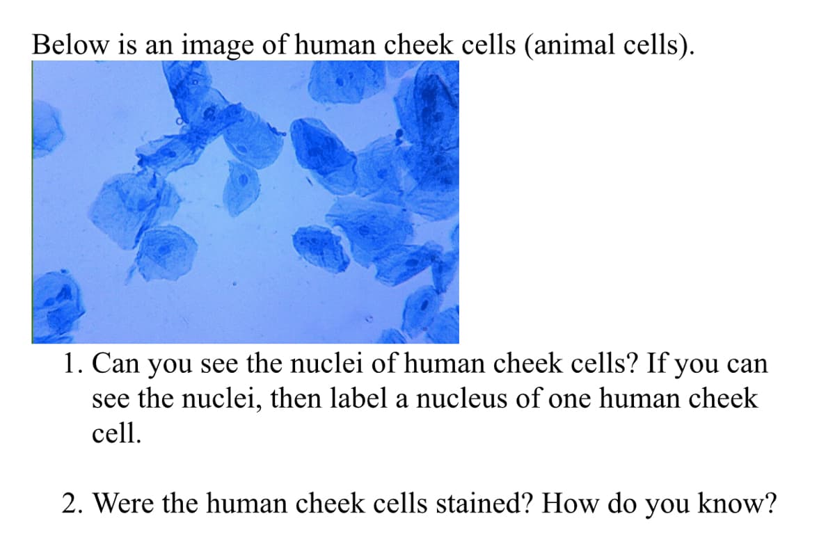 Below is an image of human cheek cells (animal cells).
1. Can you see the nuclei of human cheek cells? If you can
see the nuclei, then label a nucleus of one human cheek
cell.
2. Were the human cheek cells stained? How do you know?
