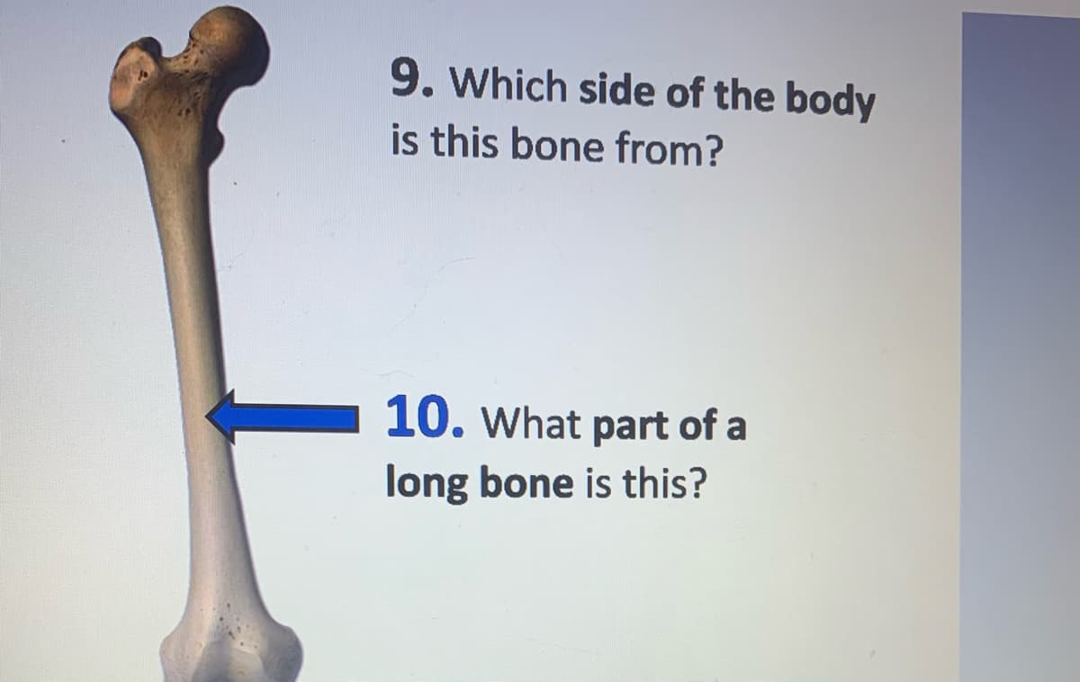 9. Which side of the body
is this bone from?
10. What part of a
long bone is this?