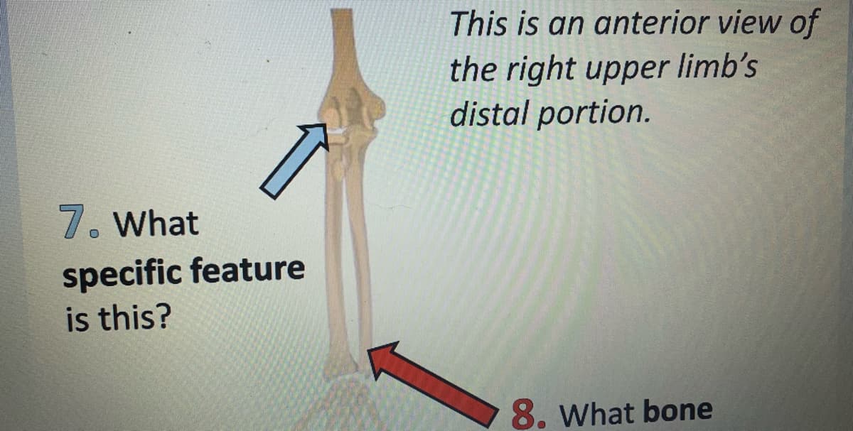 7. What
specific feature
is this?
This is an anterior view of
the right upper limb's
distal portion.
8. What bone