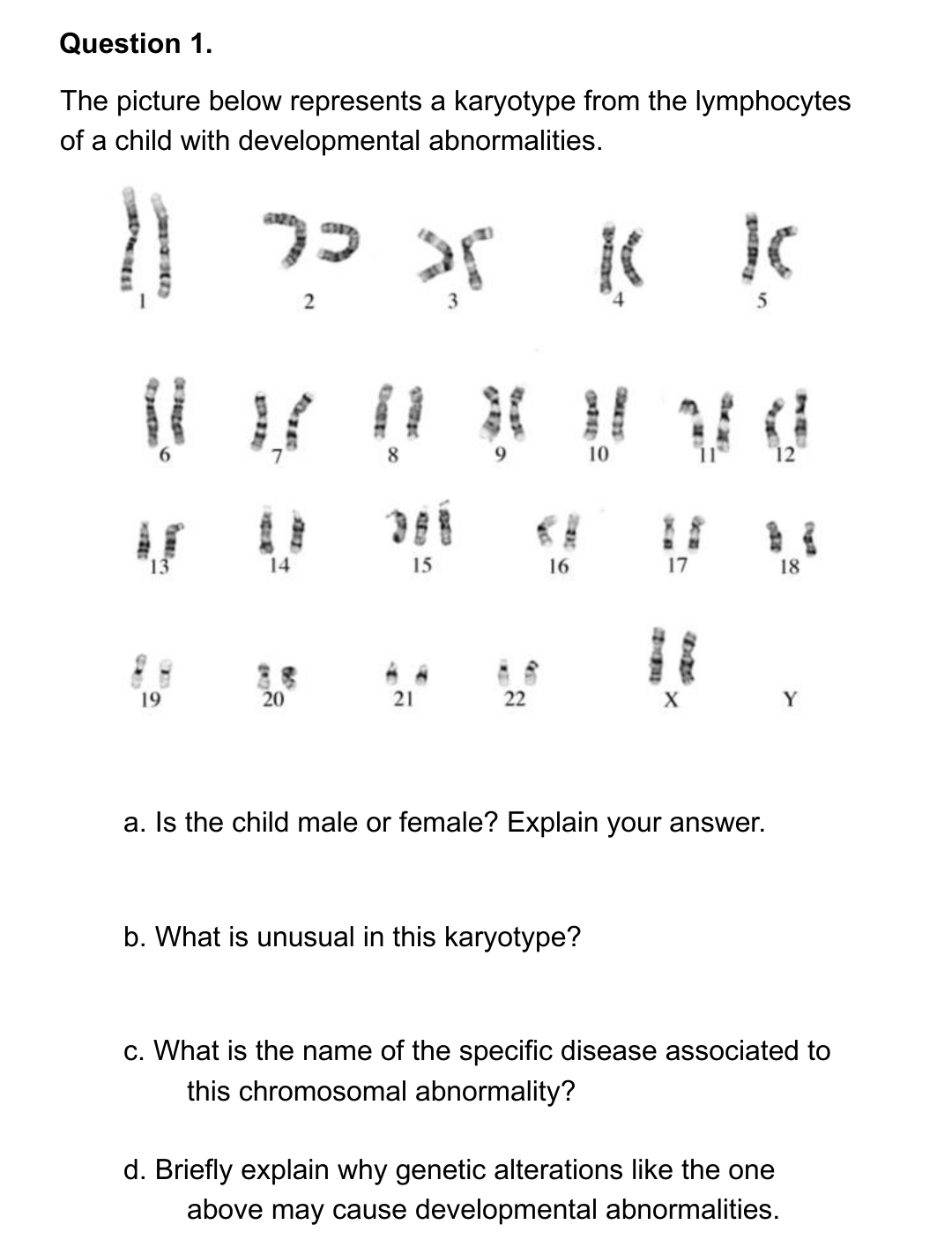 Question 1.
The picture below represents a karyotype from the lymphocytes
of a child with developmental abnormalities.
11 2² 35 K K
13
19
14
20
15
21
22
16
10
b. What is unusual in this karyotype?
17
it
X
a. Is the child male or female? Explain your answer.
18
c. What is the name of the specific disease associated to
this chromosomal abnormality?
d. Briefly explain why genetic alterations like the one
above may cause developmental abnormalities.