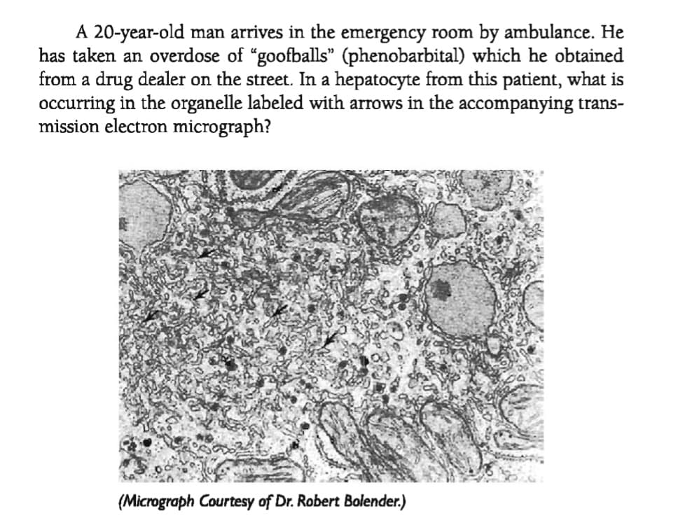 A 20-year-old man arrives in the emergency room by ambulance. He
has taken an overdose of "goofballs" (phenobarbital) which he obtained
from a drug dealer on the street. In a hepatocyte from this patient, what is
occurring in the organelle labeled with arrows in the accompanying trans-
mission electron micrograph?
(Micrograph Courtesy of Dr. Robert Bolender.)
