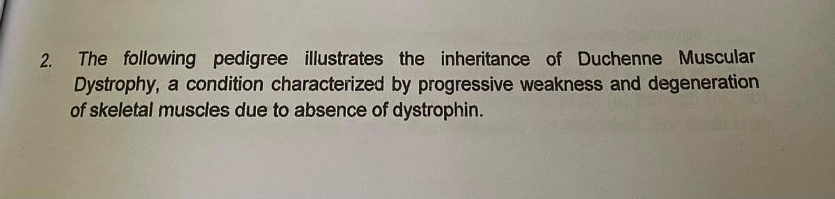 The following pedigree illustrates the inheritance of Duchenne Muscular
Dystrophy, a condition characterized by progressive weakness and degeneration
of skeletal muscles due to absence of dystrophin.
2.
