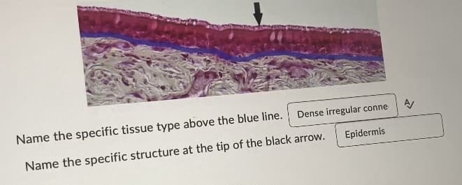 Dense irregular conne
Name the specific tissue type above the blue line.
Name the specific structure at the tip of the black arrow.
Epidermis