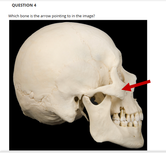 QUESTION 4
Which bone is the arrow pointing to in the image?
