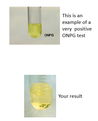 This is an
example of a
very positive
ONPO
ONPG test
Your result
