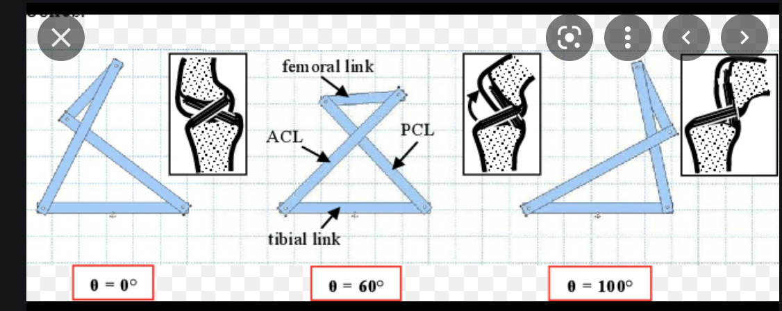 fem oral link
PCL
ACL
tibial link
0 = 0°
60°
100°
