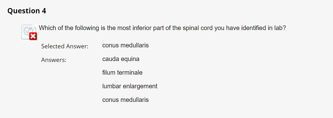 Question 4
Which of the following is the most inferior part of the spinal cord you have identified in lab?
Selected Answer:
Answers:
conus medullaris
cauda equina
filum terminale
lumbar enlargement
conus medullaris