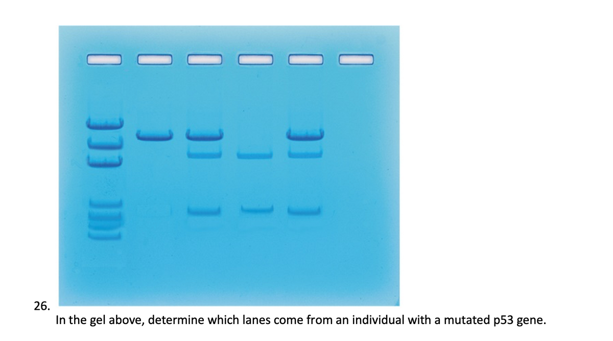 [ ]]]]]
1
]]]
[ ]]
[[[
26.
In the gel above, determine which lanes come from an individual with a mutated p53 gene.